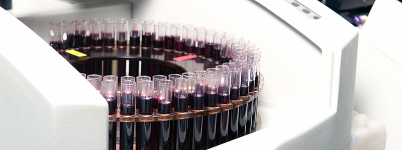 Scientists are creating a pill that will make wine less fattening