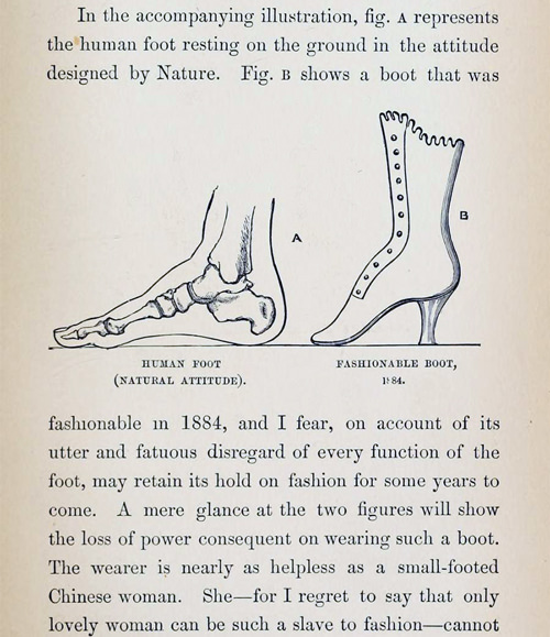 Medical Criticism Of High Heels From An 1887 Issue Of The Audubon magazine 